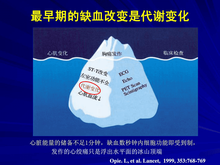 心肌能量代谢-病房[精品.ppt_第5页
