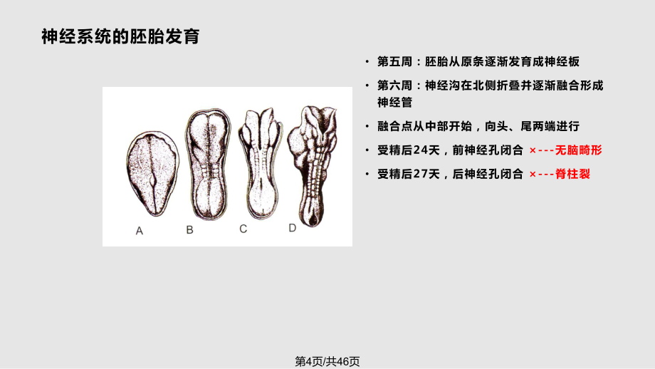 胎儿神经系统畸形的超声诊断解丽梅PPT课件_第4页